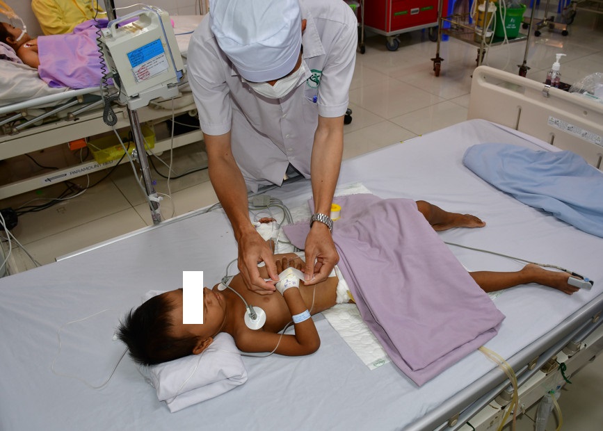 PHẪU THUẬT CẤP CỨU CHO BÉ GÁI 4 TUỔI BỊ TẮC RUỘT DO "ĂN TÓC"