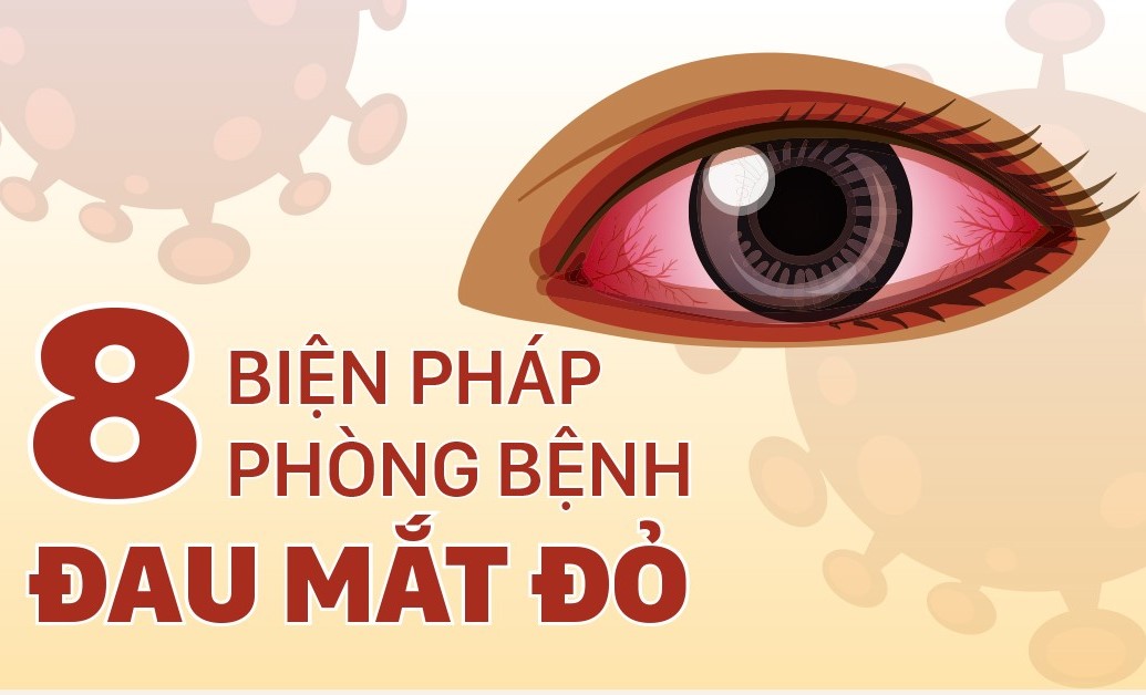 BỆNH ĐAU MẮT ĐỎ ĐANG GIA TĂNG,  CẦN PHẢI LÀM GÌ ĐỂ PHÒNG BỆNH?
